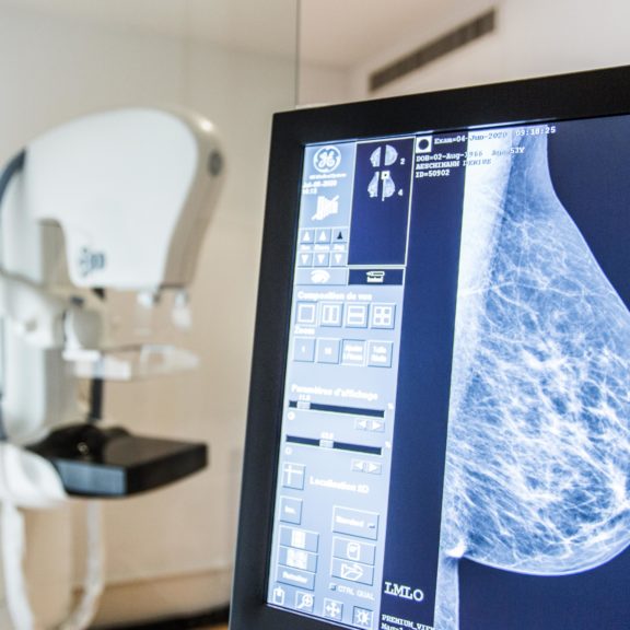 Intelligence artificielle : le nouveau partenaire du radiologue en mammographie