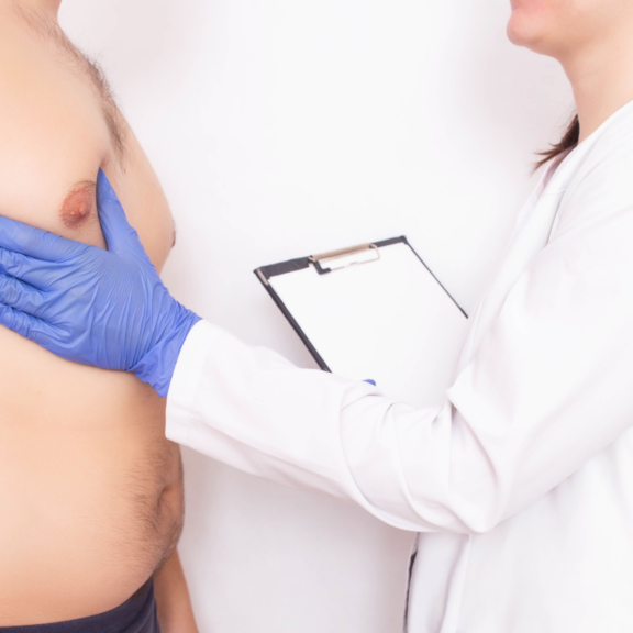 Image qui présente un médecin en train de palper le sein d'un homme pour illustrer le sujet de la gynécomastie dans le cadre de la mammographie chez l'homme pratiquée chez Medimage