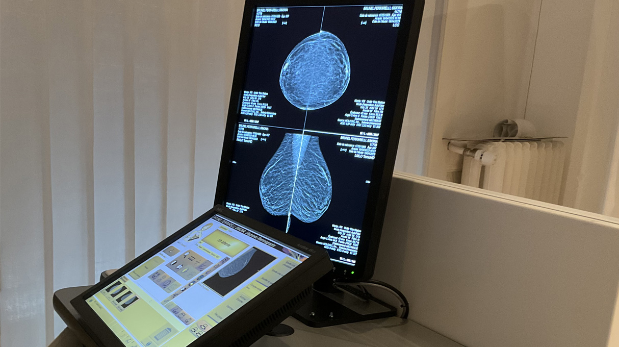 Mammographie Genève, examen médical en Suisse