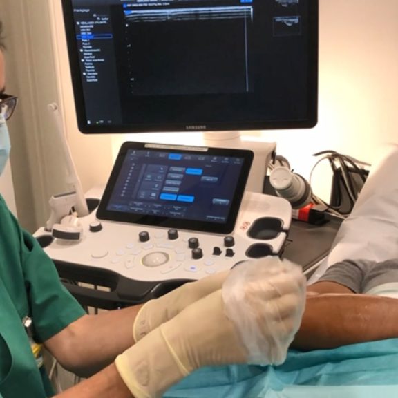 Médecin radiologue en train de pratiquer une infiltration thérapeutique du coude sous contrôle échographique