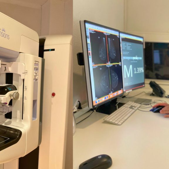 Photo d'un mammographe au centre d'imagerie médicale Medimage à Genève et d'une médecin radiologue analysant des mammographies à la recherche d'un cancer du sein