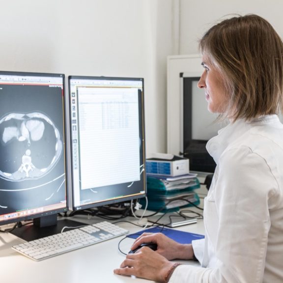 Colon, cœur, sein, prostate, poumons : l’imagerie au cœur de la prévention