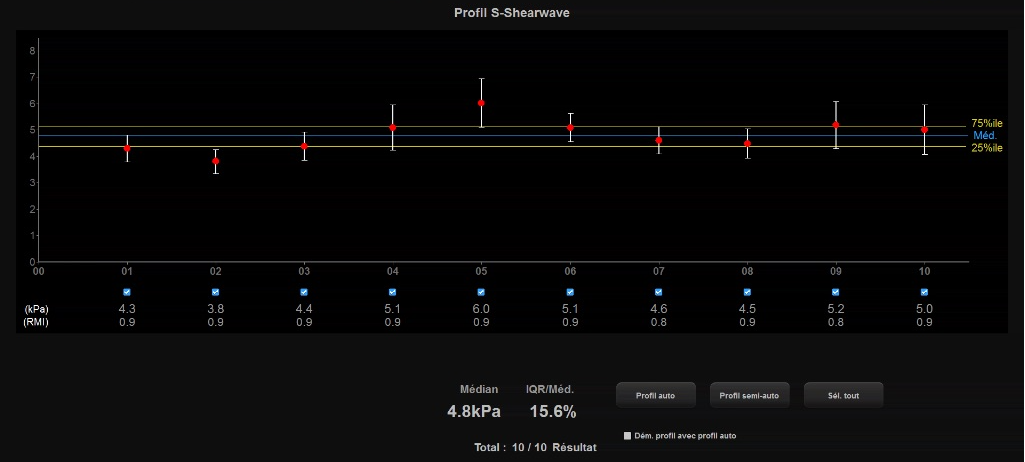 Shearwave pour analyser la séverité de l'atteinte hépatique