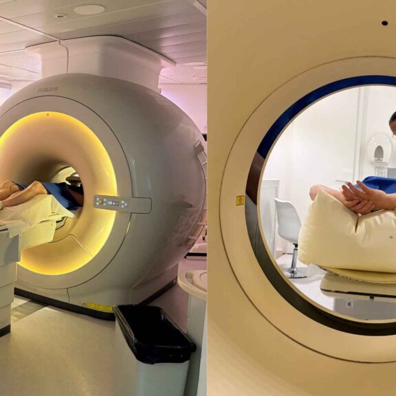 Image d'un scanner et d'un IRM pour expliquer les différences entre ces deux examens d'imagerie médicale